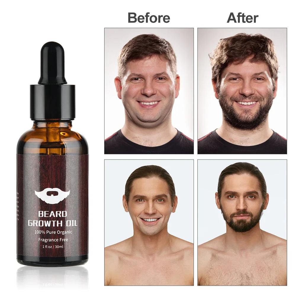 BeardThrive™ - Beard Growth Kit