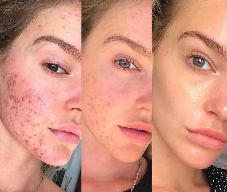 Vienlux™ - Skin Therapy Wand Machine