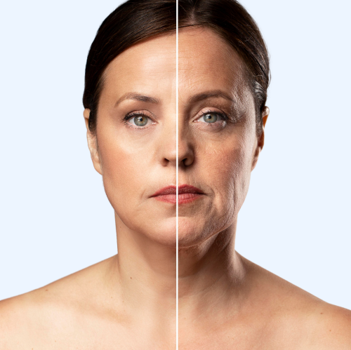 Selaviv™ -Anti-Aging Collagen - 70% OFF TODAY ONLY!