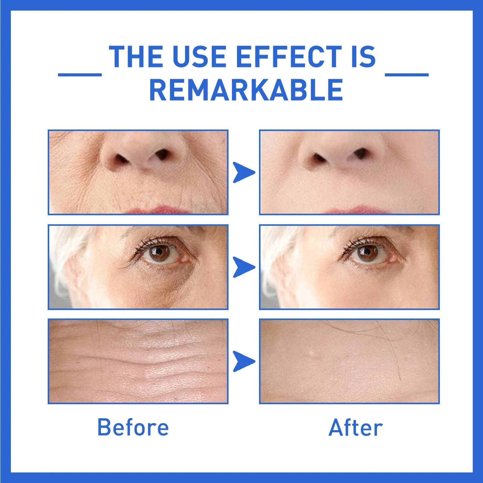 Selaviv™ -Anti-Aging Collagen - 70% OFF TODAY ONLY!